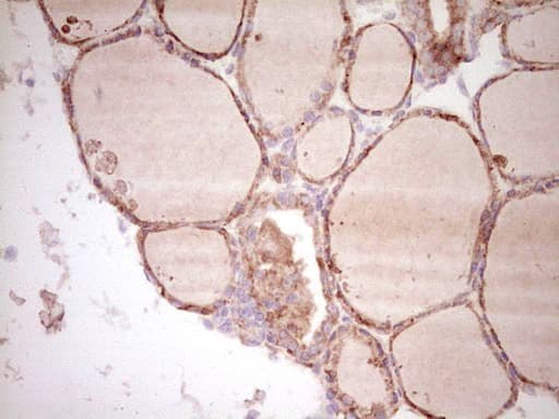 SPP1 / Osteopontin Antibody (aa17-314, clone OTI5E4)