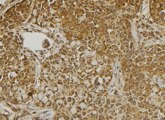 Polyclonal Rabbit anti-Human MMP28 Antibody (IHC, IF, WB)