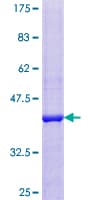 Human BLOC1S1 Protein (Recombinant GST)