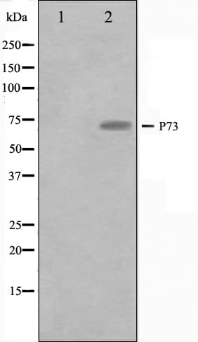 Polyclonal Rabbit anti-Human TP73 / p73 Antibody (IHC, WB)