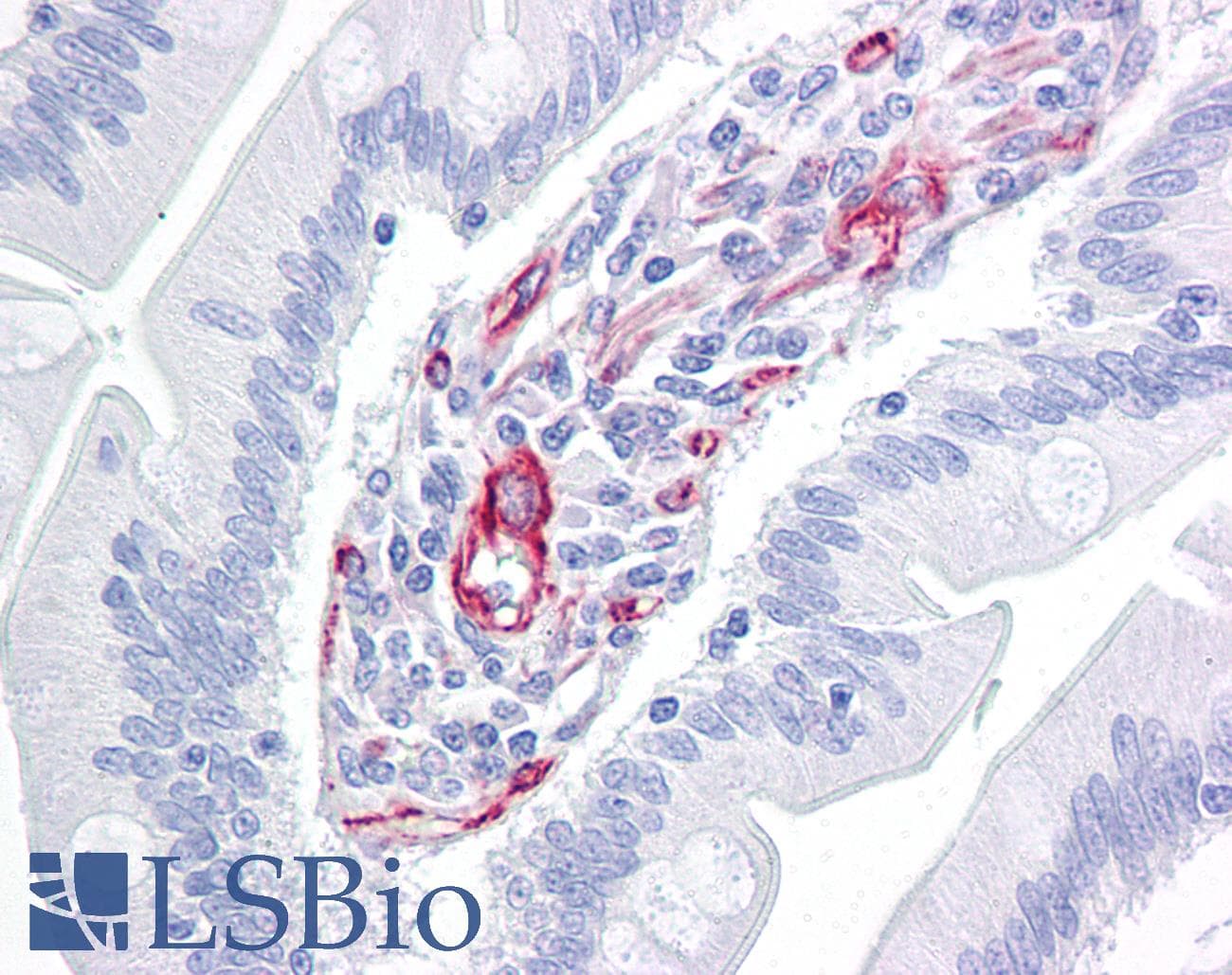PathPlus™ NES / Nestin Antibody (clone 10C2)