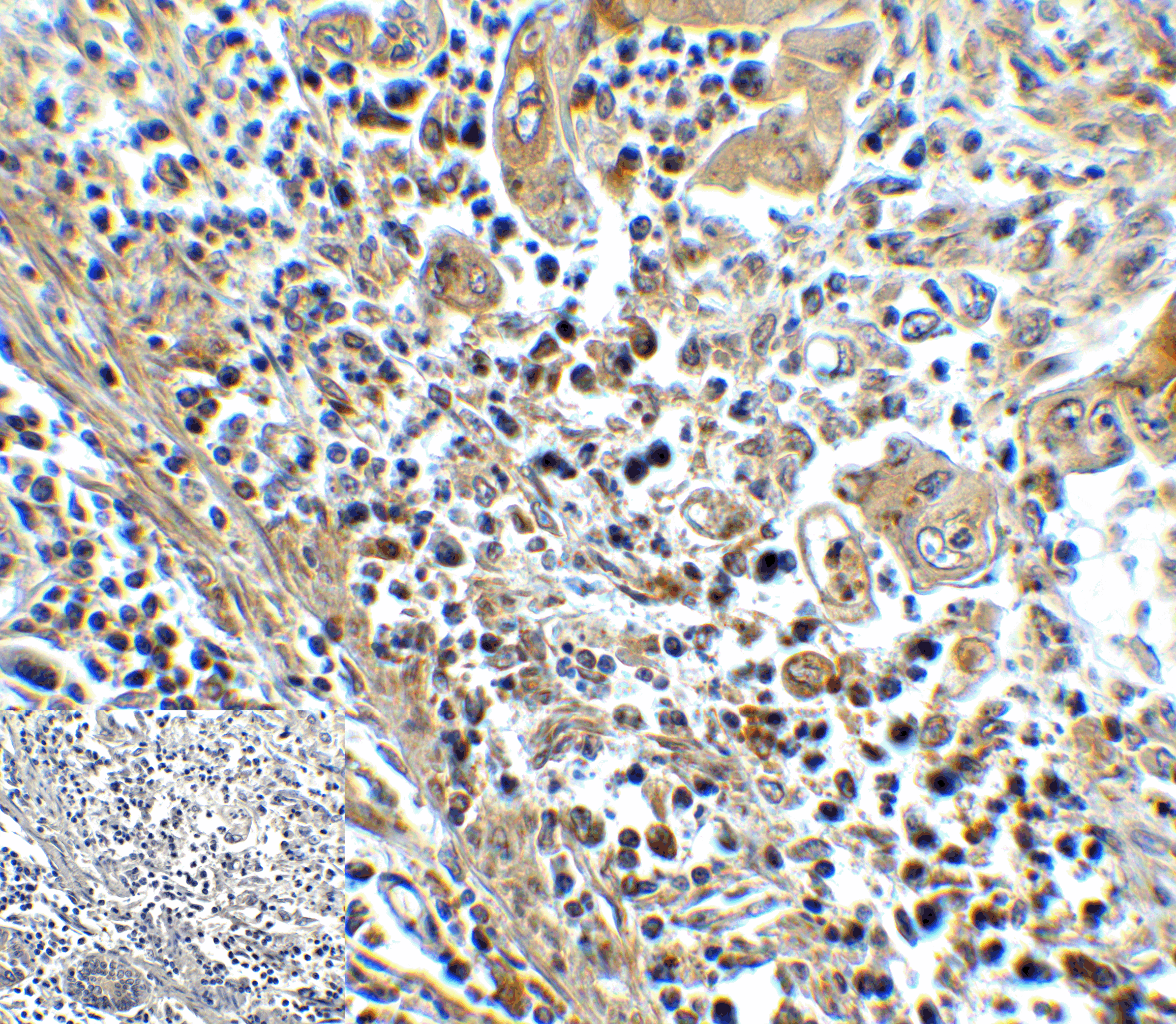 Monoclonal Mouse anti-Human HAVCR2 / TIM-3 Antibody (clone 1B10, IHC, IF, WB)