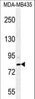 SMYD4 Antibody (aa541-568)
