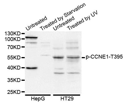 CCNE1 / Cyclin E1 Antibody (phospho-Thr395)