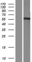 Human TRIM50 / E3 Ubiquitin Ligase Protein (Over-Expression Lysate Myc-DDK (Flag))