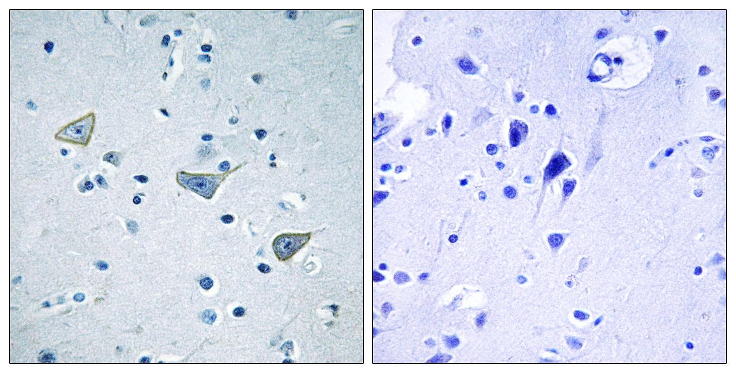 GPR158 Antibody