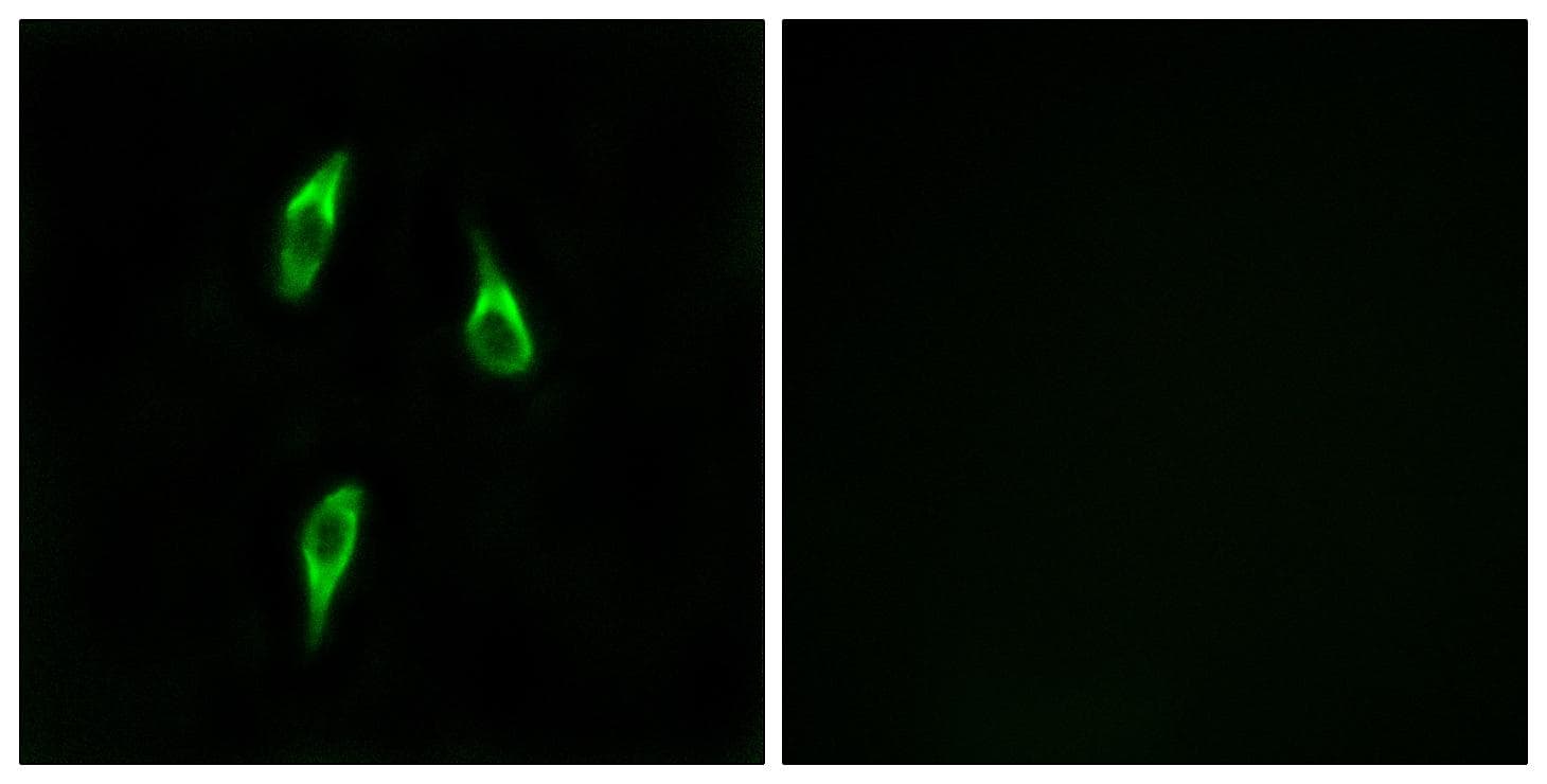 OR51B2 Antibody