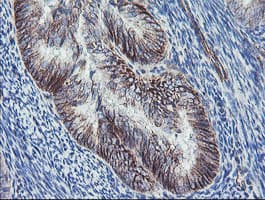 Monoclonal Mouse anti-Human DTNB / Dystrobrevin Beta Antibody (clone OTI2E6, IHC, WB)