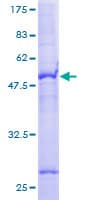 Human SLC35A2 / UGT Protein (Recombinant GST)