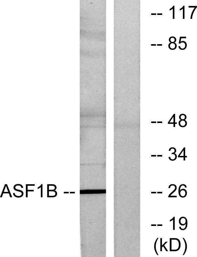 Polyclonal Rabbit anti-Human ASF1B Antibody (aa101-150, WB)