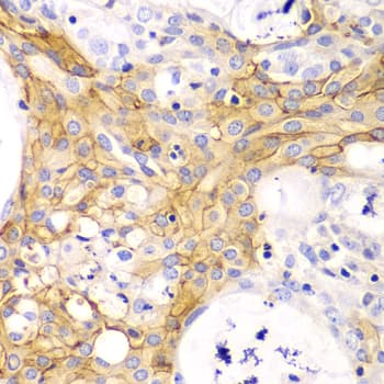 Polyclonal Rabbit anti-Human ACTA2 / Smooth Muscle Actin Antibody (IHC, WB)