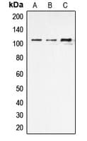Polyclonal Rabbit anti-Human ARTS1 / ERAP1 Antibody (Internal, IHC, IF, WB)