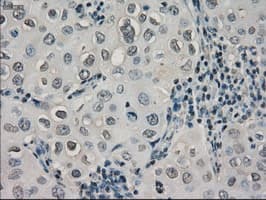 CRYAB / Alpha B Crystallin Antibody (clone OTI3C2)