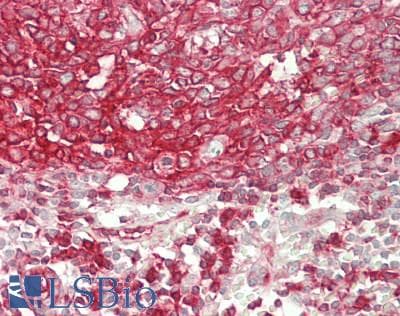 IHC-plus™ MARCKSL1 Antibody (aa145-195)