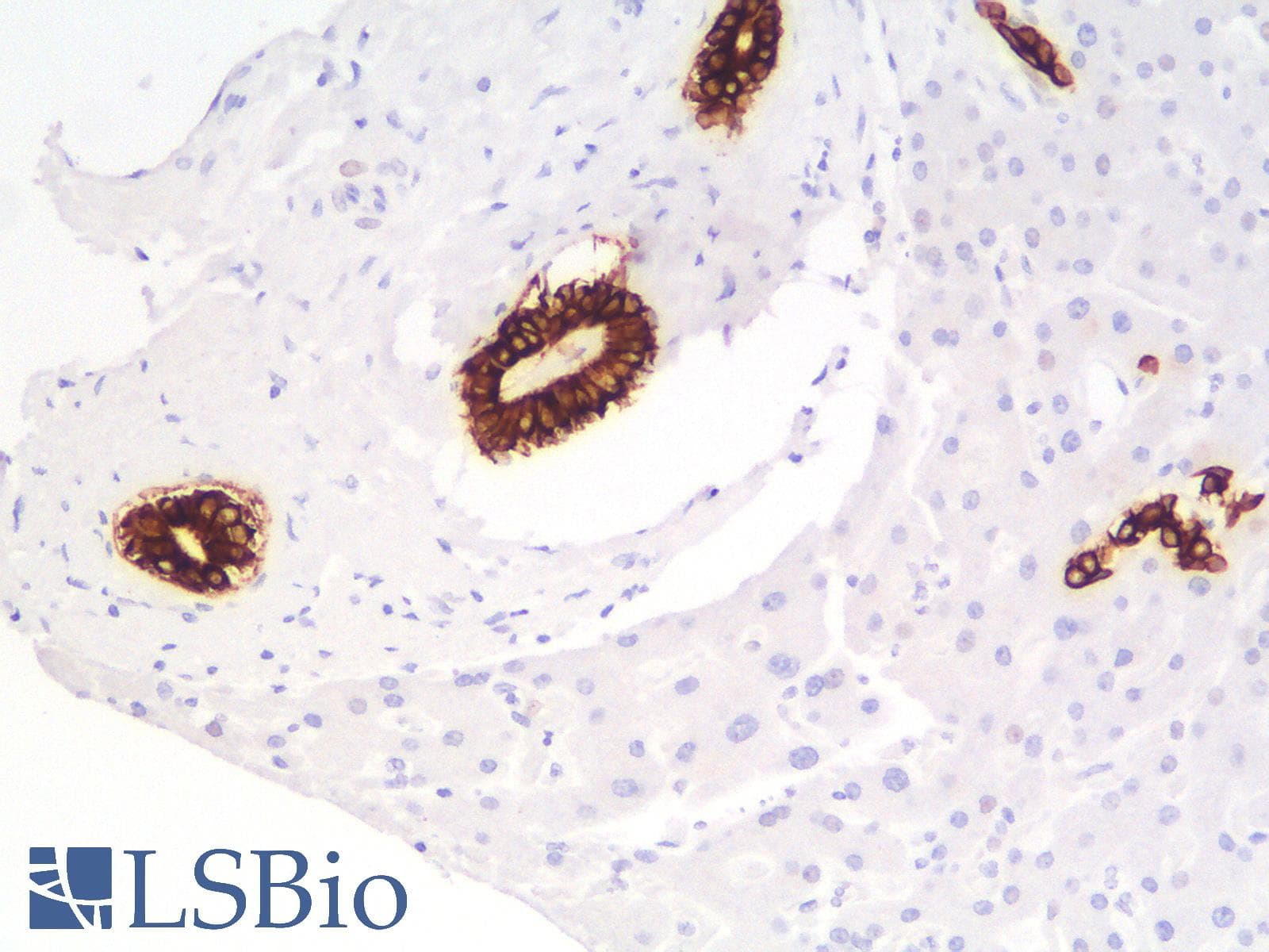 PathPlus™ KRT7 / CK7 / Cytokeratin 7 Antibody (clone rOV-TL12/30)