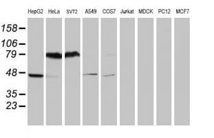 SERPINB1 Antibody (aa77-306, clone OTI2B4)