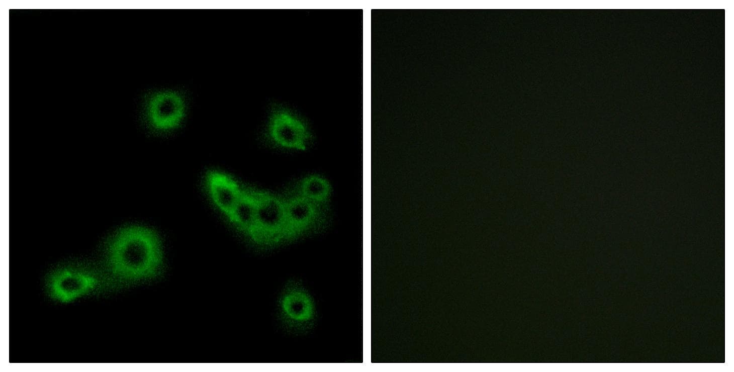 SLC52A1 / GPR172B / PAR2 Antibody