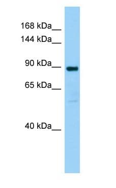 Polyclonal Rabbit anti-Rat SMPD4 Antibody (aa301-350, WB)