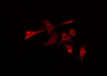 OR56B4 Antibody