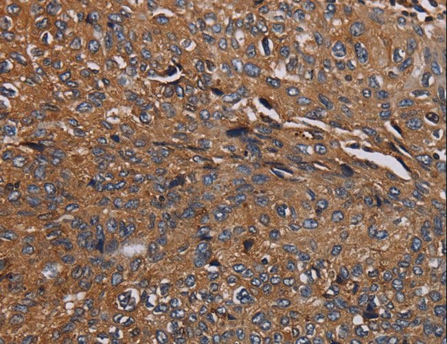 HYAL2 Antibody