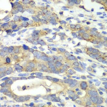 CHMP2B Antibody