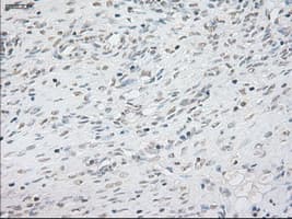 Monoclonal Mouse anti-Human NEUROG1 / NGN1 / Neurogenin 1 Antibody (clone OTI5A10, IHC, WB)