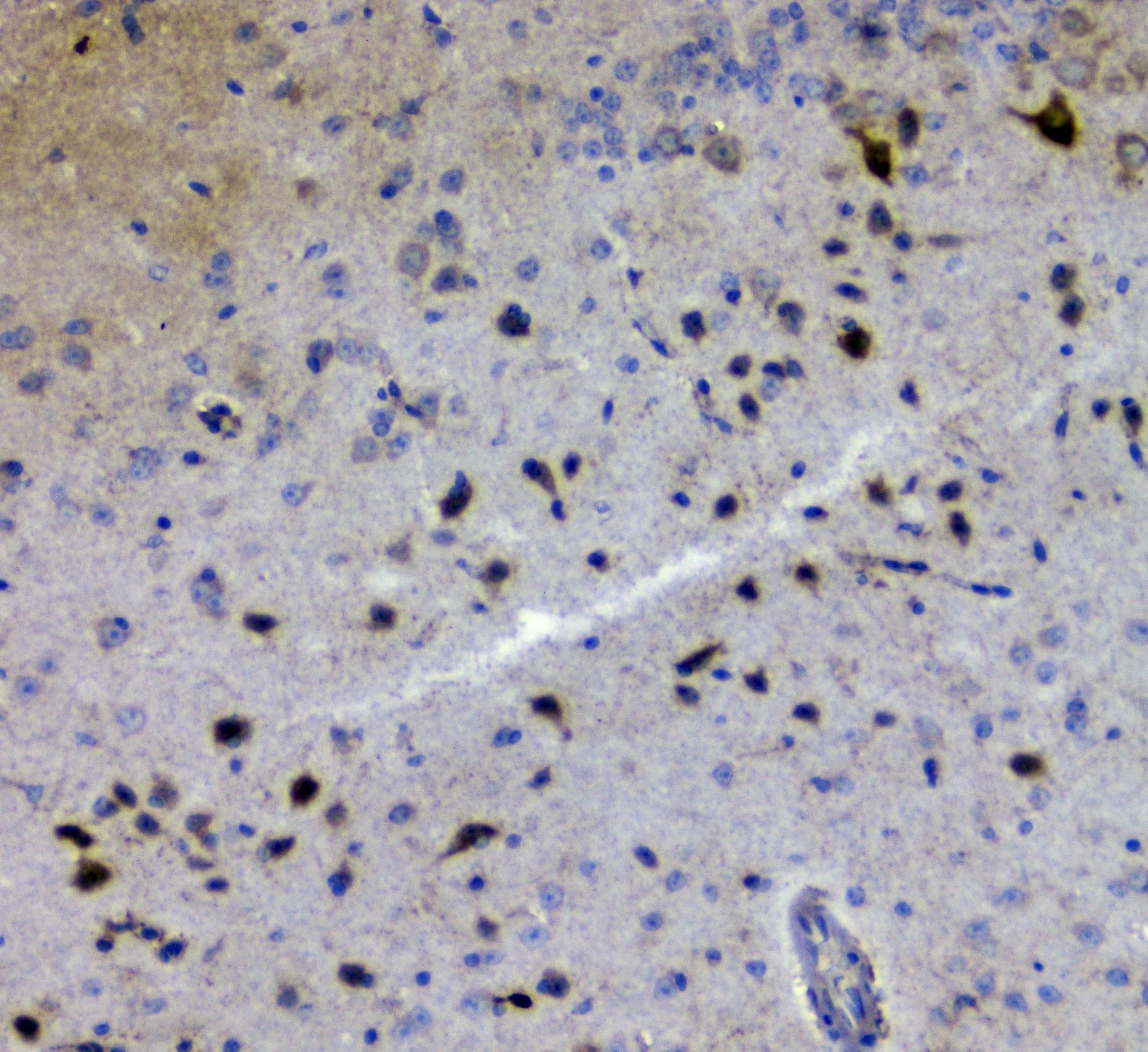 Polyclonal Rabbit anti-Human GRIK1 / GLUR5 Antibody (aa271-450, WB)