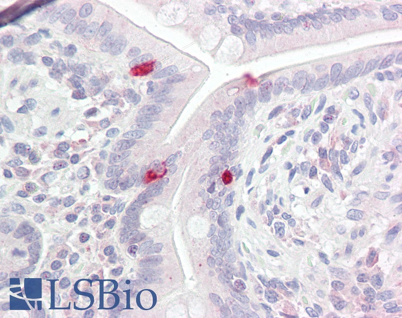 IHC-plus™ Polyclonal Rabbit anti-Human BRN2 / POU3F2 Antibody (aa240-290, IHC, WB)