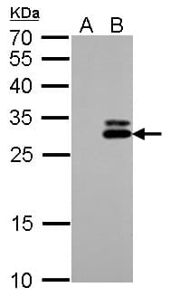 IHC-plus™ Polyclonal Rabbit anti-Human KLK7 / Kallikrein 7 Antibody (aa1-253, IHC, WB)