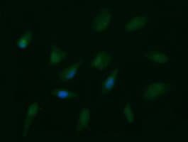 FAK / Focal Adhesion Kinase Antibody (clone OTI4A8)