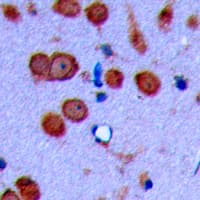 CDH19 / Cadherin 19 Antibody (Internal)
