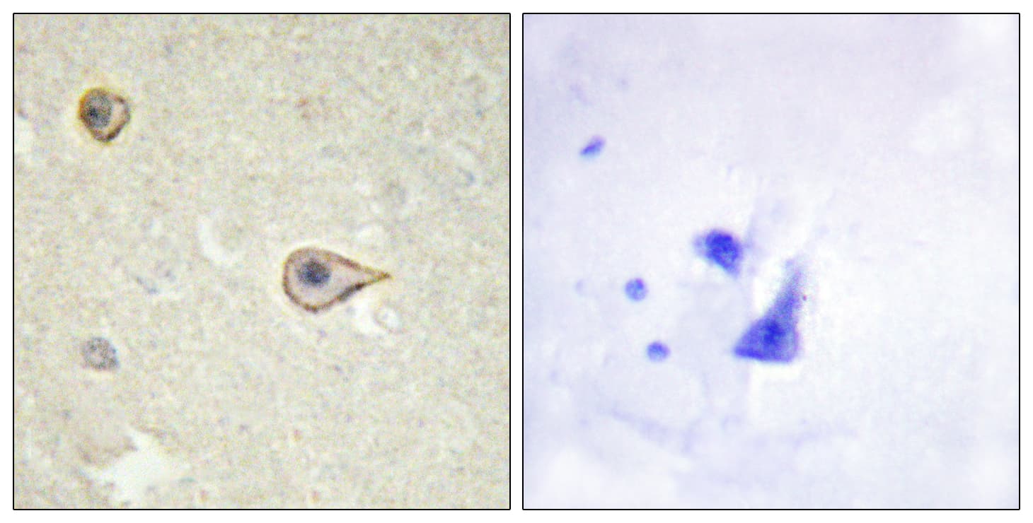 CYP19 / Aromatase Antibody (aa221-270)