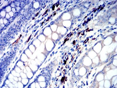 IGLC2 Antibody (clone 5E12B9)