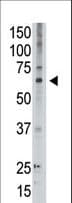 MAGED2 Antibody (aa576-606)