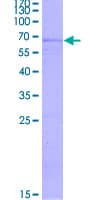 Human GPER1 / GPR30 Protein (Recombinant GST)