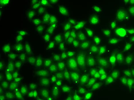 Polyclonal Rabbit anti-Human TXNL4B Antibody (IHC, IF, WB)