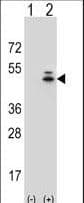 IHC-plus™ ACTG1 / Gamma Actin Antibody (aa188-215)
