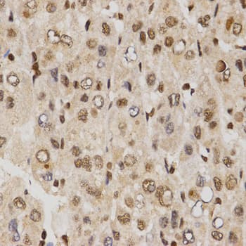 IHC-plus™ Polyclonal Rabbit anti-Human SKIV2L2 Antibody (IHC, WB)
