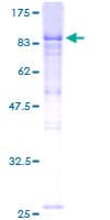 Human KBTBD2 Protein (Recombinant GST)