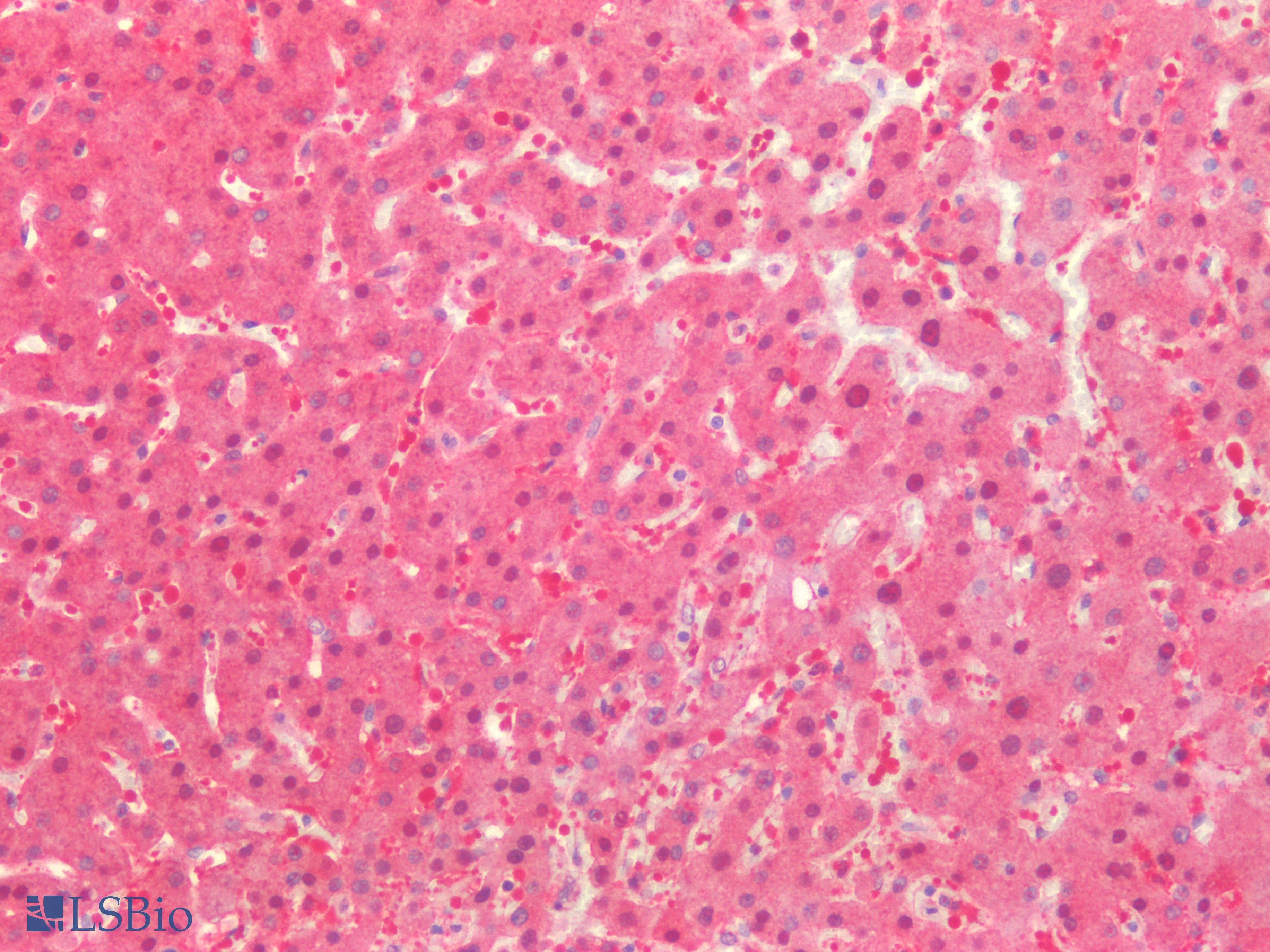 PathPlus™ LDHA / LDH1 Antibody