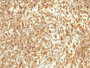 CD20 Antibody (clone L26 + IGEL/733)