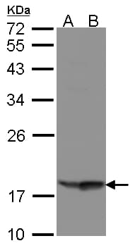 Polyclonal Rabbit anti-Human RARRES3 Antibody (aa69-164, WB)