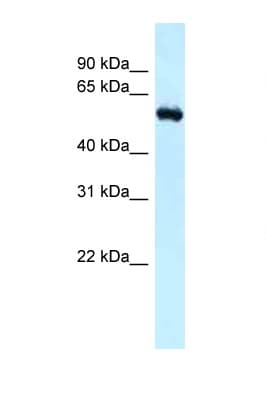 RBBP5 Antibody (N-Terminus)