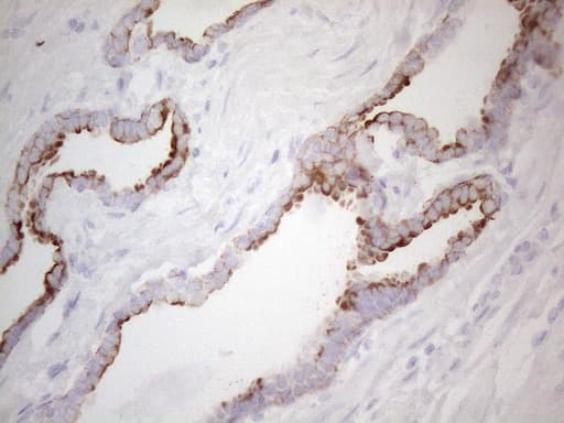 KRT19 / CK19 / Cytokeratin 19 Antibody (aa240-390, clone UMAB187, Carrier-free)
