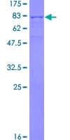 Human PLEKHO1 / CKIP-1 Protein (Recombinant GST)
