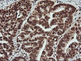 FAK / Focal Adhesion Kinase Antibody (clone OTI4D11)