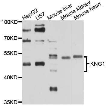 Polyclonal Rabbit anti-Human KNG1 / Kininogen / Bradykinin Antibody (IHC, WB)