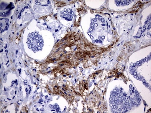 MCAM / CD146 Antibody (clone OTI5C4)