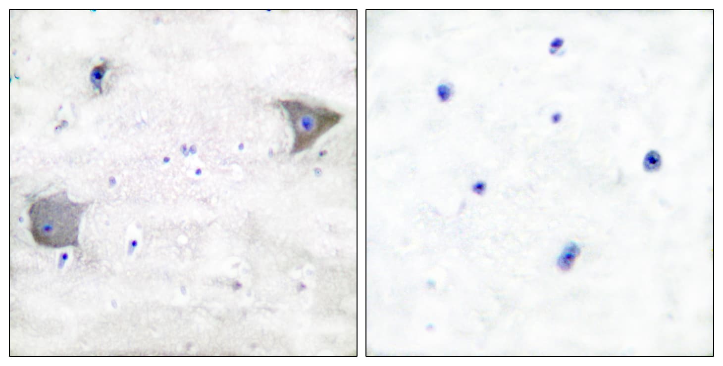 PDGFRA / PDGFR Alpha Antibody (aa1031-1080)