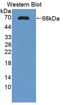 TRAIL-R3 / DCR1 Antibody (aa32-244)